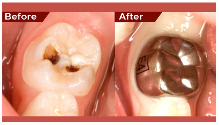pediatric dentist in Abu Dhabi